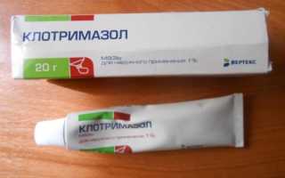 Клотримазол мазь: отзывы. Мазь клотримазол при беременности: особенности применения