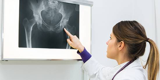 Лечение тазобедренного сустава в домашних условиях без операции