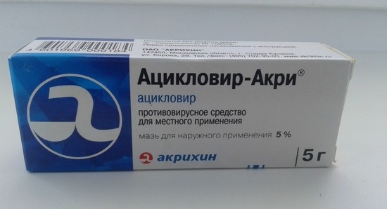 человек уже заразился ветрянкой, медицина может предложить «Ацикловир»