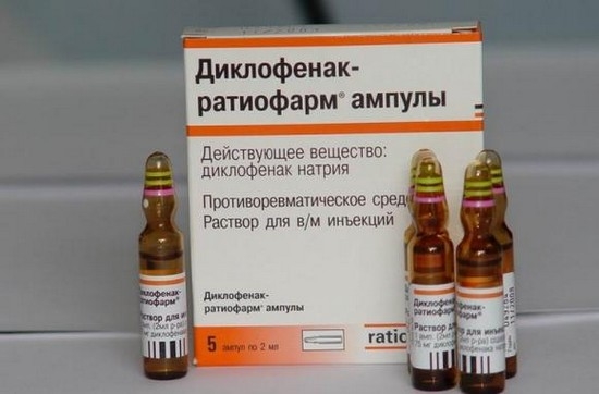 Шейный остеохондроз необходимо лечить комплексно