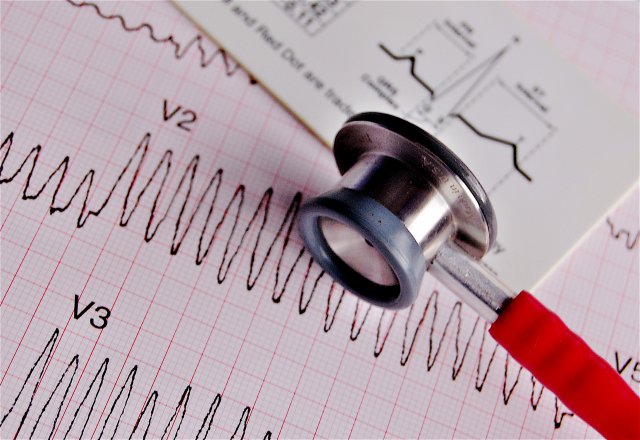 Стетоскоп и ЭКГ