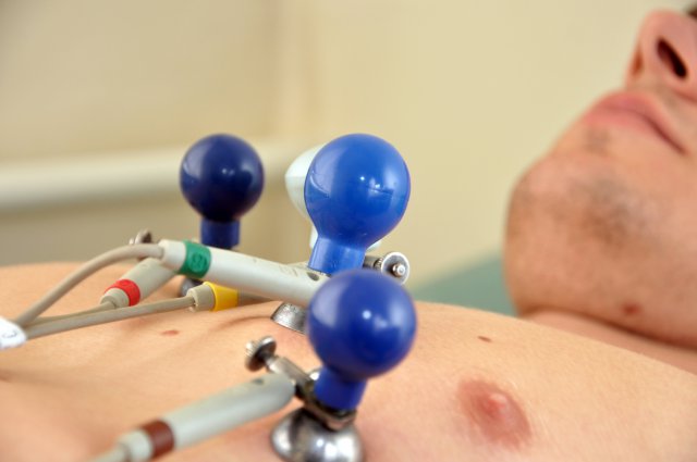 Снятие электрокардиограммы