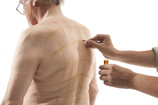 Йодовая сетка