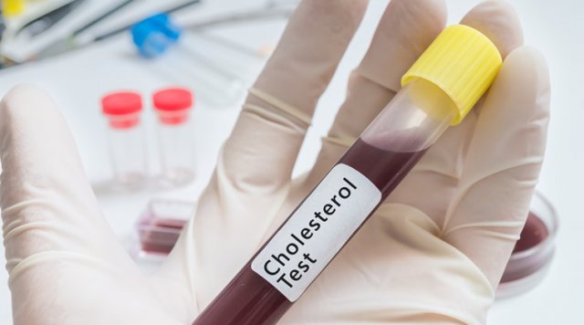 Кровь на холестерин