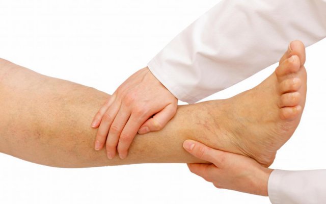 Врач массирует ногу